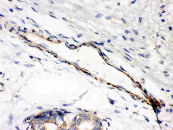 Immunohistochemistry of Anti-Caldesmon (smooth) antibody