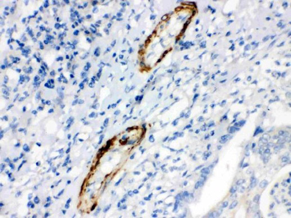 Immunohistochemistry of Anti-Caldesmon (smooth) antibody