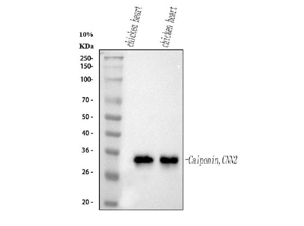 Western blot analysis of Calponin/CNN2