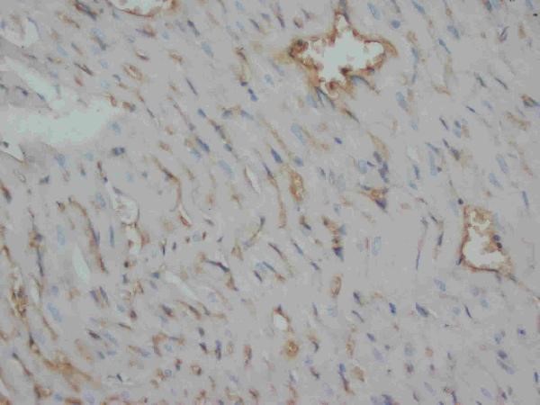 Immunohistochemistry analysis of Desmin