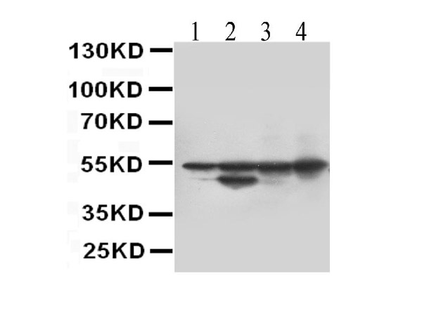 Western blot analysis of Desmin