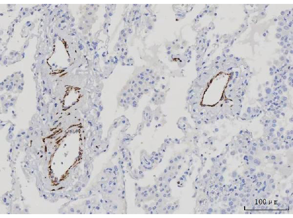 Immunohistochemistry analysis of Desmin