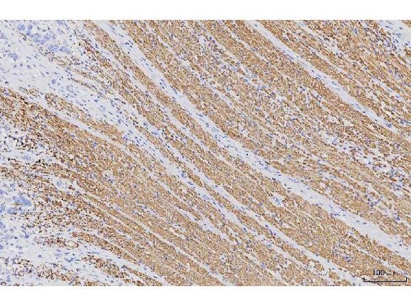 Immunohistochemistry analysis of Desmin