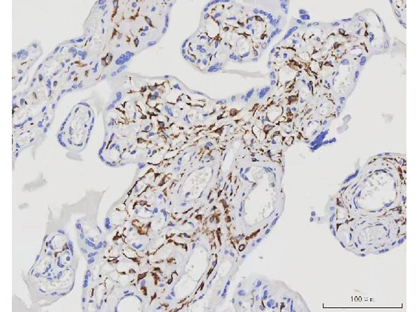 Immunohistochemistry analysis of Desmin