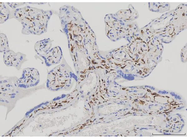 Immunohistochemistry analysis of Desmin