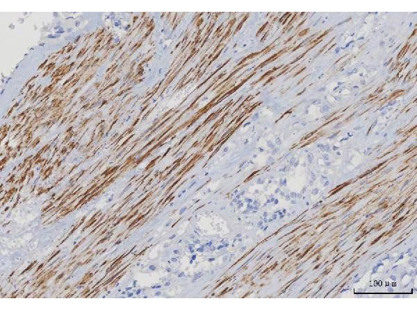 Immunohistochemistry analysis of Desmin