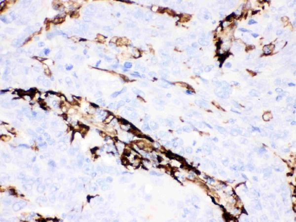 Immunohistochemistry of Anti-Gelsolin antibody