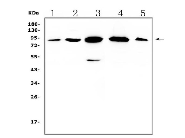 Western blot analysis of Gelsolin