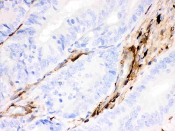 Immunohistochemistry of Anti-Gelsolin antibody