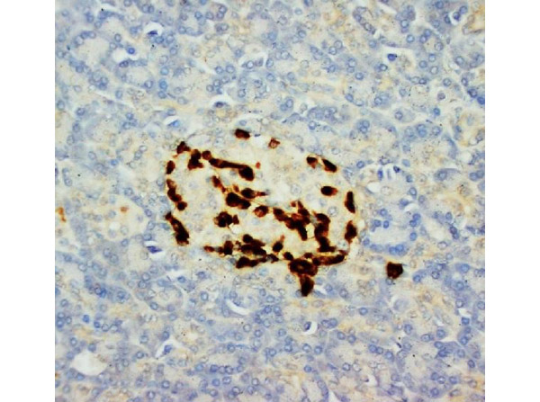 Immunohistochemistry analysis of Glucagon