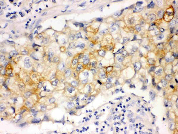 Immunohistochemistry analysis of Involucrin