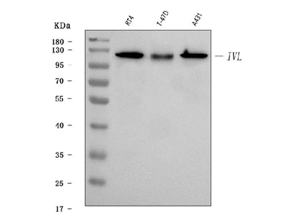 Western Blot analysis of Involucrin