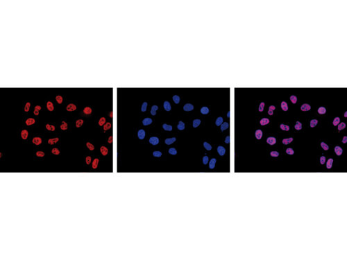 Immunofluorescence Microscopy of anti-Pol II S2p antibody