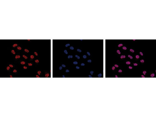 Immunofluorescence Microscopy of anti-Pol II S5p antibody