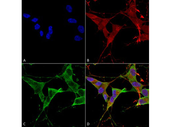 Immunofluorescence of Mouse Anti-LAR/PTPRF
