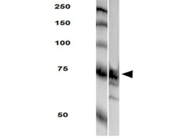 Western Blot of Anti-LAR