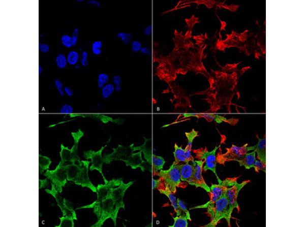 Immunofluorescence of Mouse Anti-LAR/PTPRF
