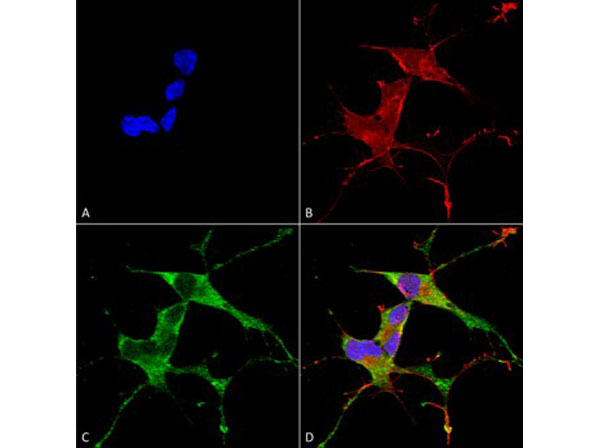 Immunofluorescence of Mouse Anti-LRRK2/Dardarin