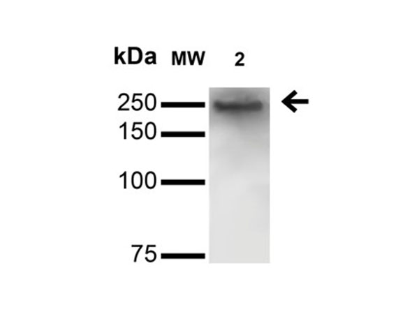 Western Blot analysis of Mouse Anti-LRRK2/Dardarin