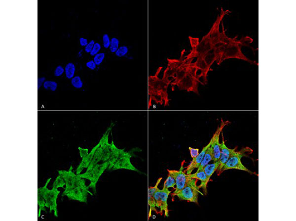 Immunofluorescence of Mouse Anti-LRRK2/Dardarin