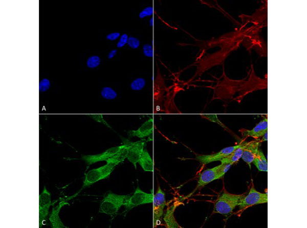 Immunofluorescence of Mouse Anti-LRRK2/Dardarin