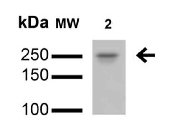 Western Blot of Mouse Anti-LRRK2/Dardarin