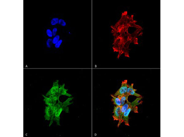 Immunofluorescence of Mouse Anti-LRRK2/Dardarin
