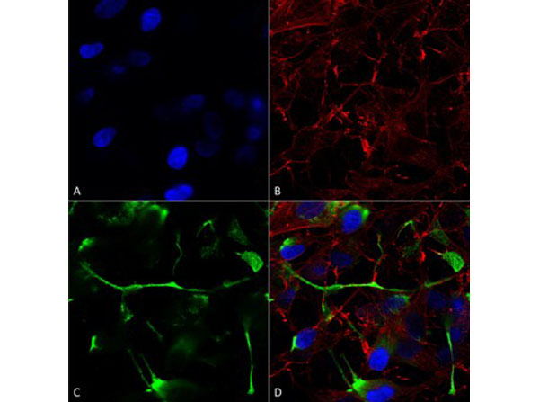 Immunofluorescence of Mouse Anti-ATF4