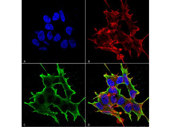 Immunofluorescence of Mouse Anti-ATF4