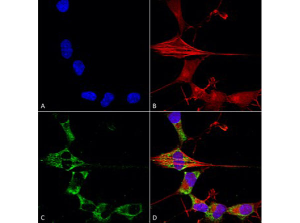 Immunofluorescence of Mouse Anti-FGFA/FHFA