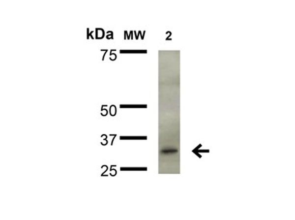 Western Blot of Anti-FGFA/FHFA