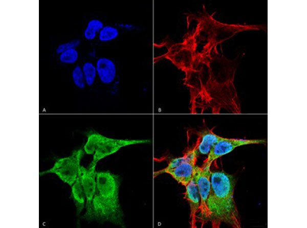 Immunofluorescence of Mouse Anti-FGFA/FHFA