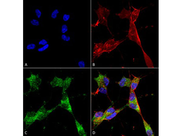 Immunofluorescence of Mouse Anti-PINK1