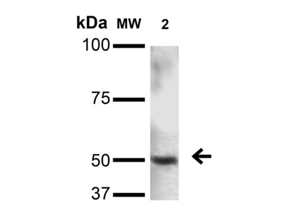 Western Blot of Anti-PINK1