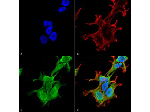 Immunofluorescence of Mouse Anti-PINK1