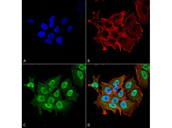 Immunofluorescence of Mouse Anti-Ataxin 1 Monoclonal Antibody