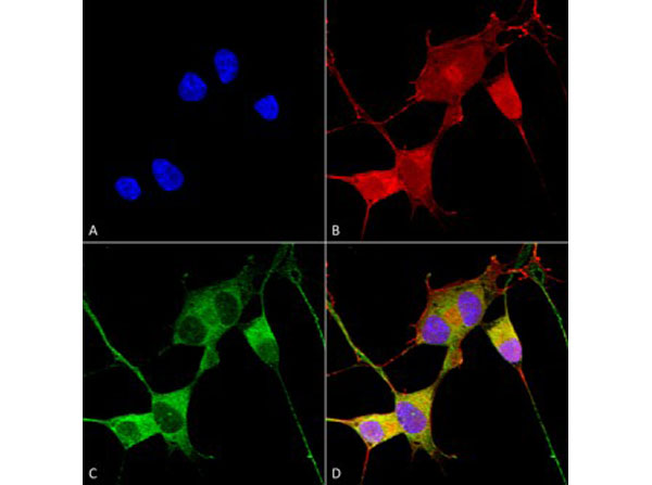 Immunofluorescence of Mouse Anti-Ataxin 1 Monoclonal Antibody