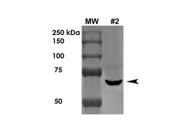 Western Blot of Mouse Anti-LGI1 Monoclonal Antibody