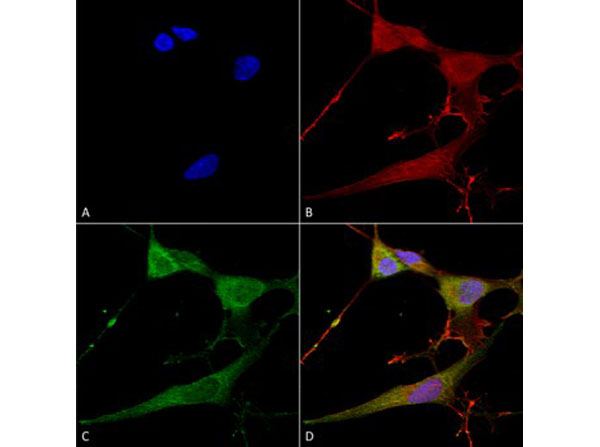 Immunofluorescence of Mouse Anti-NrCAM Monoclonal Antibody