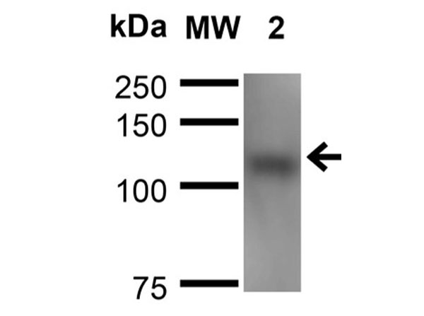 Western Blot of Mouse Anti-Neuroligin 1 Monoclonal Antibody