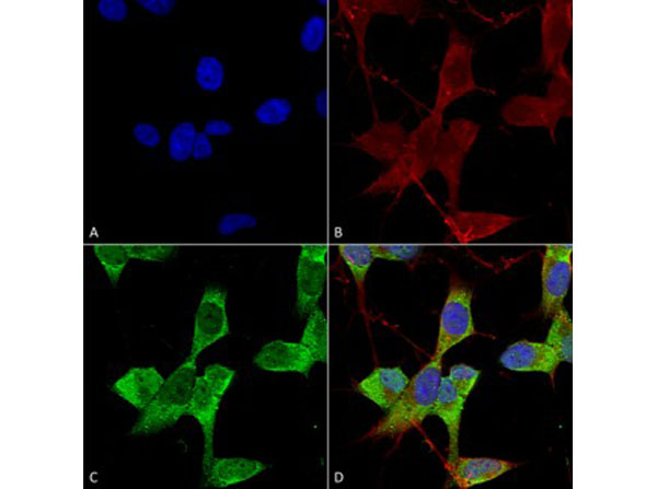 Immunofluorescence of Mouse Anti-TASK1 Potassium Channel Monoclonal Antibody