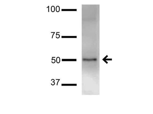 Western Blot of Mouse Anti-TASK1 Potassium Channel Monoclonal Antibody