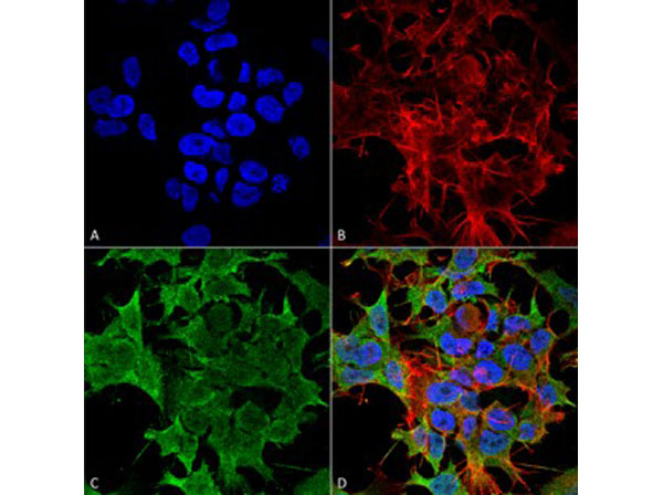 Immunofluorescence of Mouse Anti-TASK1 Potassium Channel Monoclonal Antibody