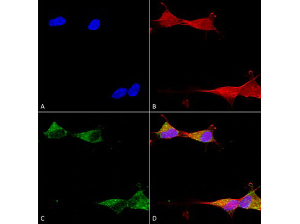 Immunofluorescence of Mouse Anti-Ataxin 1 Monoclonal Antibody