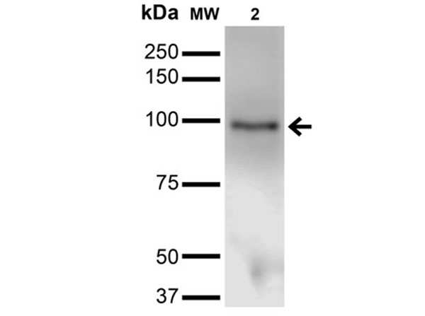 Western Blot of Mouse Anti-Ataxin 1 Monoclonal Antibody