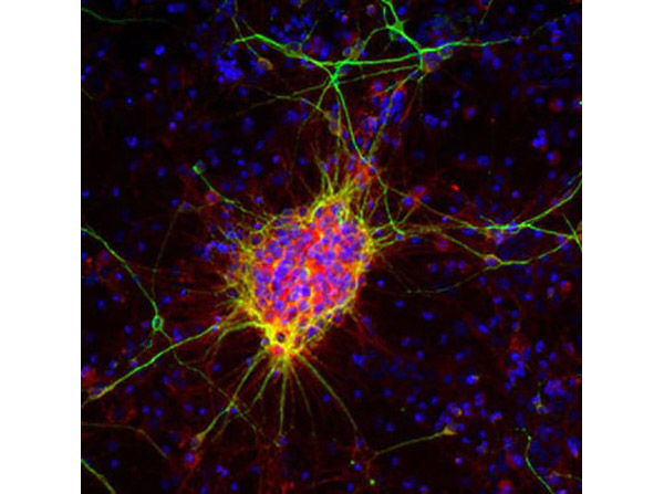 Immunofluorescence of Anti-Doublecortin Antibody