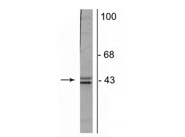 Westrn Blot of Anti-Doublecortin Antibody