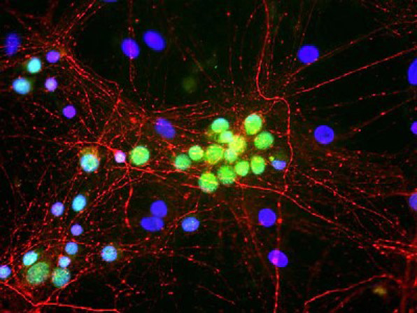 Immunofluorescence of Anti-FOX1