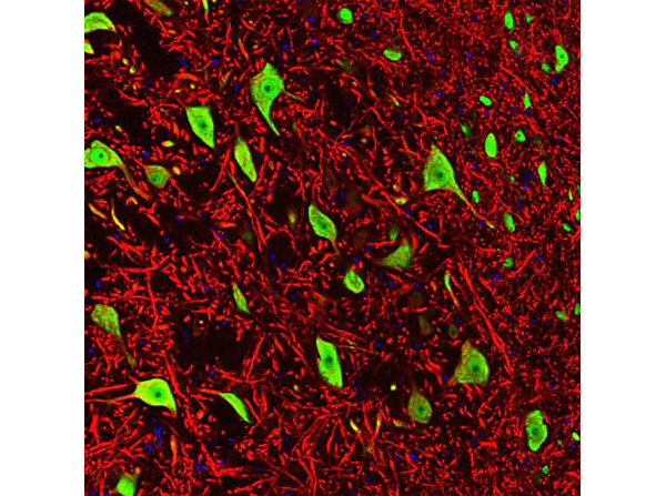 Immunofluorescence with Anti-FOX3