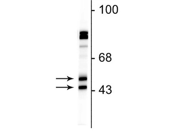 Western blot of Anti-FOX3 antibody